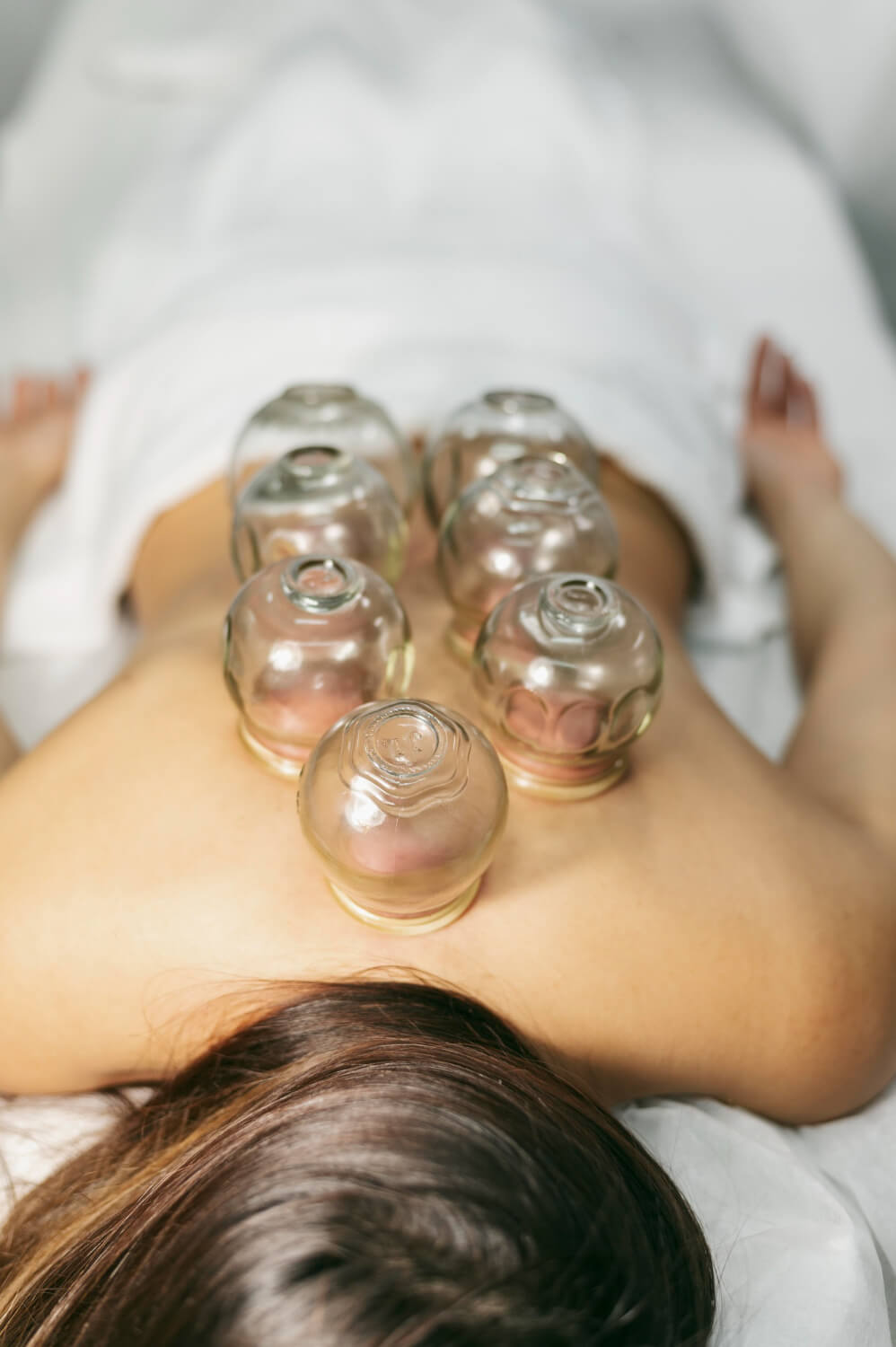 cupping therapy near me