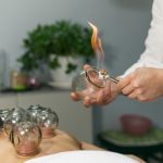 acupuncture vs cupping