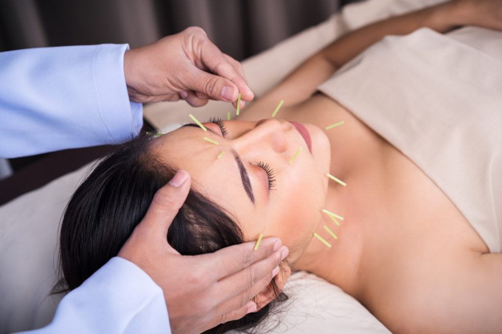 facial acupuncture Toronto